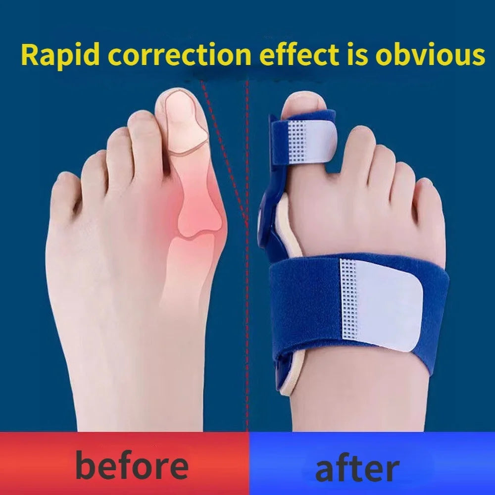 Bunion Ease Ultra™